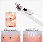 Pore Cleanser Ultrasonic Blackhead Remover Device